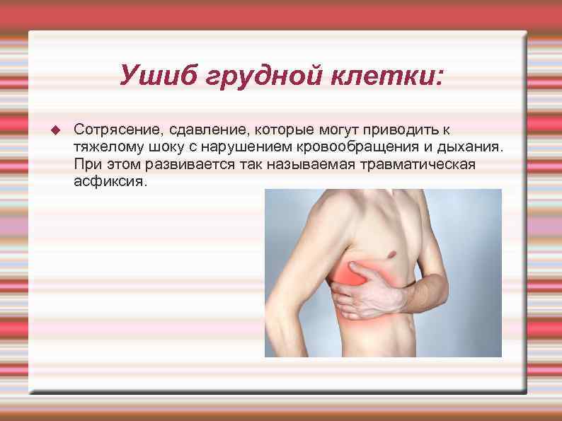   Ушиб грудной клетки: Сотрясение, сдавление, которые могут приводить к тяжелому шоку