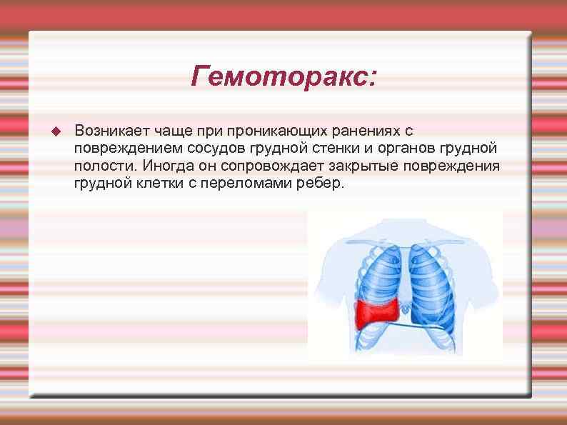    Гемоторакс: Возникает чаще при проникающих ранениях с повреждением сосудов грудной стенки