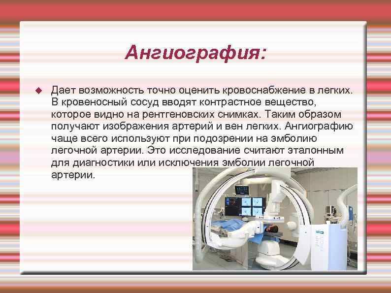    Ангиография: Дает возможность точно оценить кровоснабжение в легких. В кровеносный сосуд