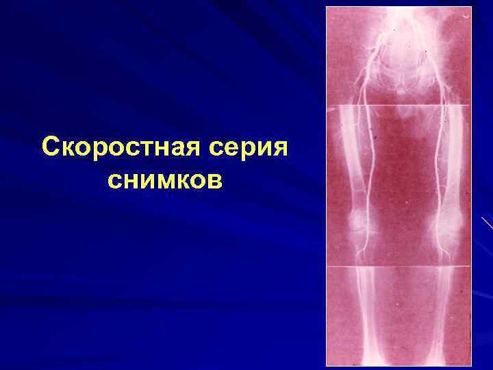 Скоростная серия снимков 