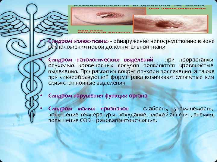 • Синдром «плюс-ткань» - обнаружение непосредственно в зоне расположения новой дополнительной ткани • Синдром «плюс-ткань» - обнаружение непосредственно в зоне расположения новой дополнительной ткани