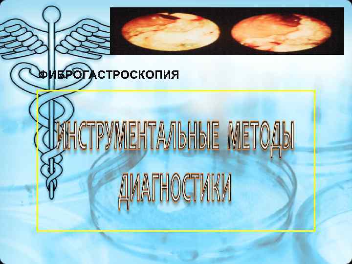 ФИБРОГАСТРОСКОПИЯ ФИБРОГАСТРОСКОПИЯ