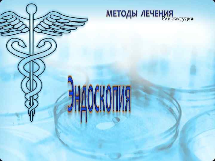 Рак желудка Рак желудка