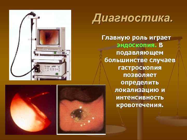 Диагностика.  Главную роль играет  эндоскопия. В подавляющем  большинстве случаев  гастроскопия