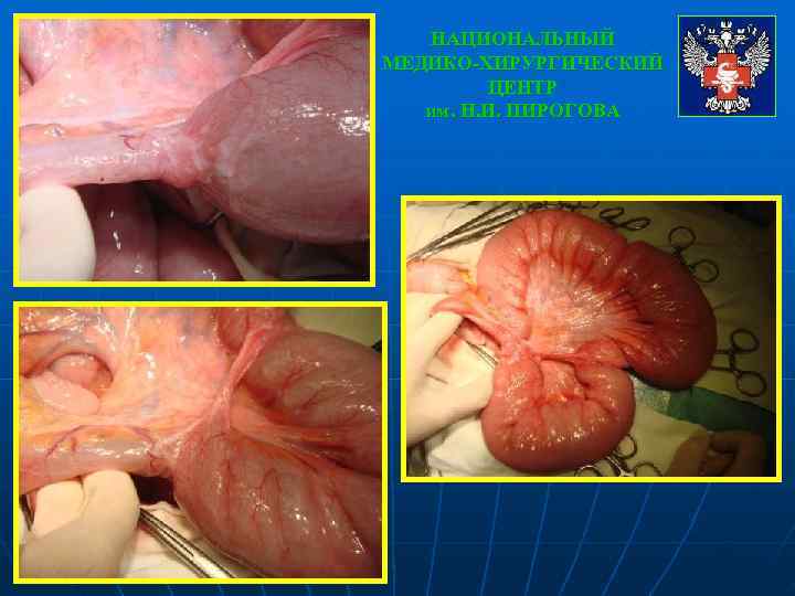   НАЦИОНАЛЬНЫЙ МЕДИКО-ХИРУРГИЧЕСКИЙ   ЦЕНТР  им. Н. И. ПИРОГОВА 