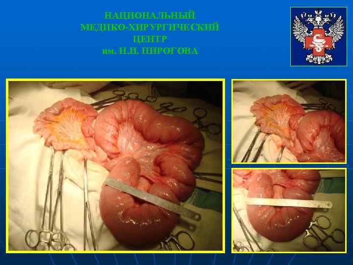  НАЦИОНАЛЬНЫЙ МЕДИКО-ХИРУРГИЧЕСКИЙ   ЦЕНТР  им. Н. И. ПИРОГОВА 