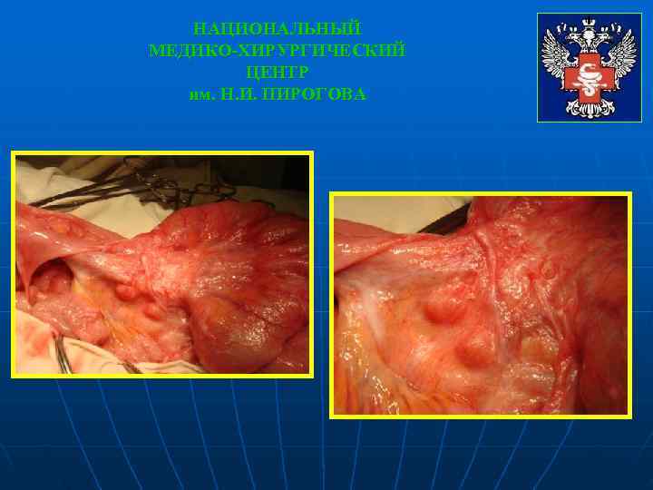   НАЦИОНАЛЬНЫЙ МЕДИКО-ХИРУРГИЧЕСКИЙ   ЦЕНТР  им. Н. И. ПИРОГОВА 