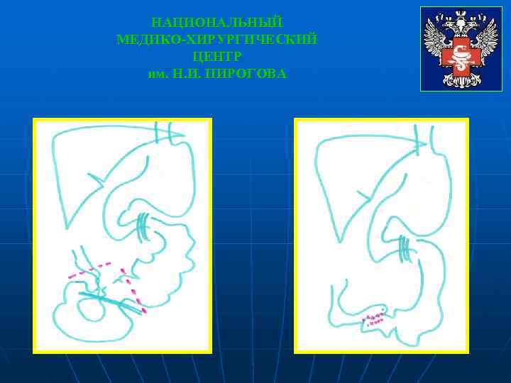   НАЦИОНАЛЬНЫЙ МЕДИКО-ХИРУРГИЧЕСКИЙ   ЦЕНТР  им. Н. И. ПИРОГОВА 