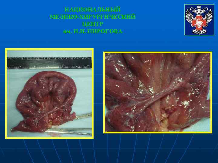   НАЦИОНАЛЬНЫЙ МЕДИКО-ХИРУРГИЧЕСКИЙ   ЦЕНТР  им. Н. И. ПИРОГОВА 