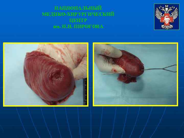   НАЦИОНАЛЬНЫЙ МЕДИКО-ХИРУРГИЧЕСКИЙ   ЦЕНТР  им. Н. И. ПИРОГОВА 