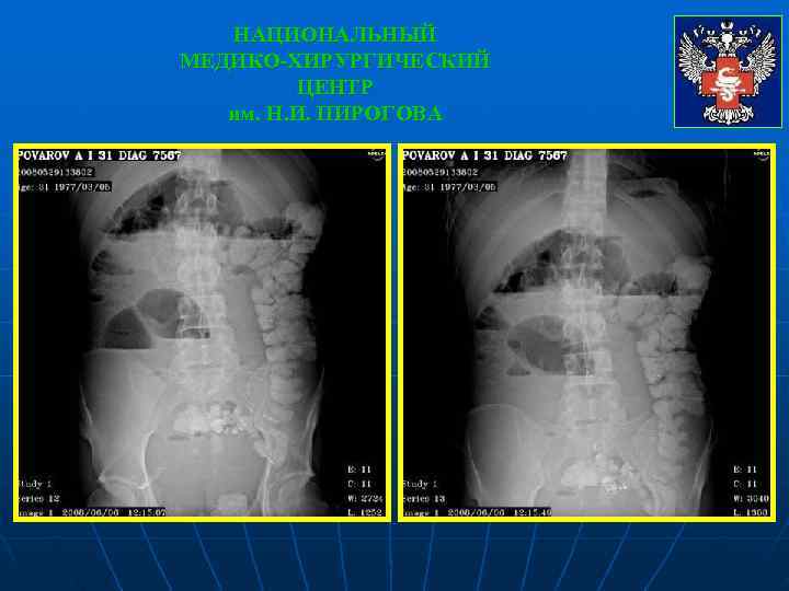   НАЦИОНАЛЬНЫЙ МЕДИКО-ХИРУРГИЧЕСКИЙ   ЦЕНТР  им. Н. И. ПИРОГОВА 