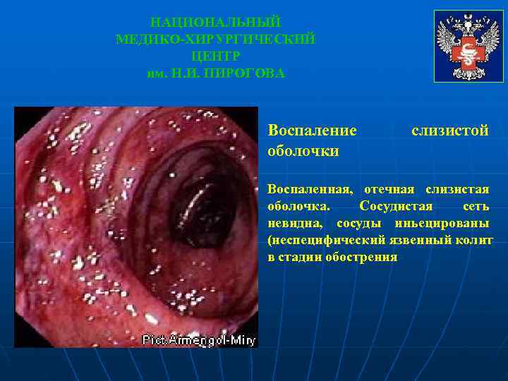   НАЦИОНАЛЬНЫЙ МЕДИКО-ХИРУРГИЧЕСКИЙ   ЦЕНТР  им. Н. И. ПИРОГОВА  