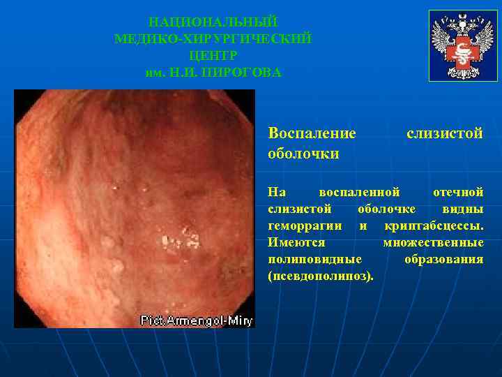   НАЦИОНАЛЬНЫЙ МЕДИКО-ХИРУРГИЧЕСКИЙ   ЦЕНТР  им. Н. И. ПИРОГОВА  