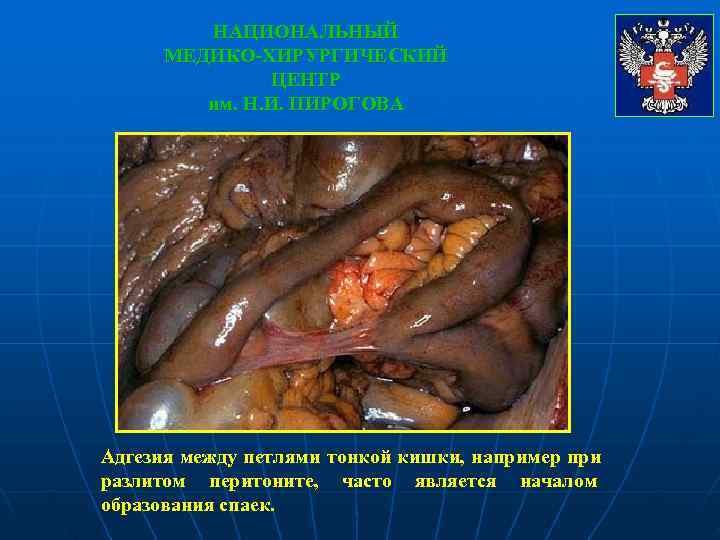    НАЦИОНАЛЬНЫЙ  МЕДИКО-ХИРУРГИЧЕСКИЙ    ЦЕНТР   им. Н.