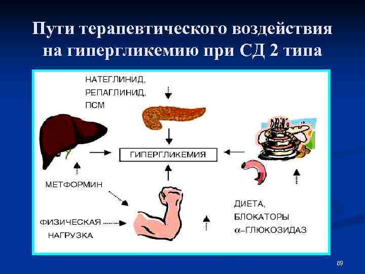 Пути терапевтического воздействия на гипергликемию при СД 2 типа     