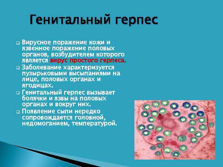  Генитальный герпес q  Вирусное поражение кожи и язвенное поражение половых органов, возбудителем