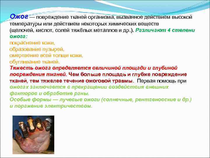 Ожог — повреждение тканей организма, вызванное действием высокой температуры или действием некоторых химических веществ