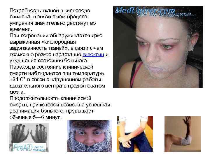 Потребность тканей в кислороде снижена, в связи с чем процесс умирания значительно растянут во