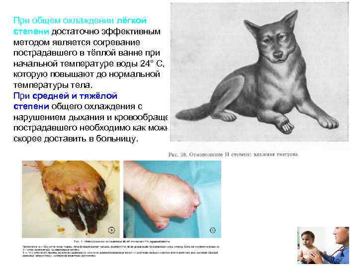 При общем охлаждении лёгкой степени достаточно эффективным методом является согревание пострадавшего в тёплой ванне