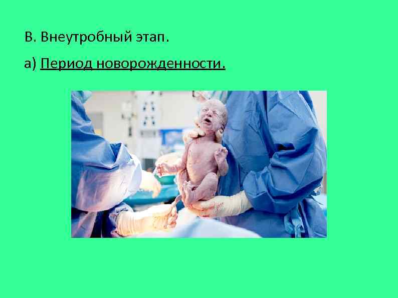 В. Внеутробный этап. а) Период новорожденности. 