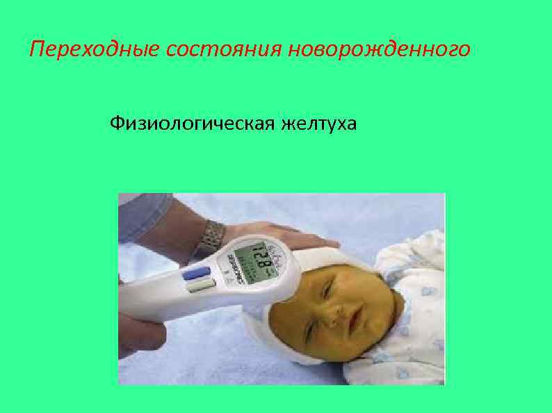 Переходные состояния новорожденного  Физиологическая желтуха 