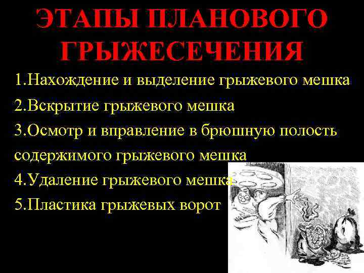  ЭТАПЫ ПЛАНОВОГО  ГРЫЖЕСЕЧЕНИЯ 1. Нахождение и выделение грыжевого мешка 2. Вскрытие грыжевого