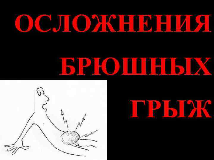 ОСЛОЖНЕНИЯ  БРЮШНЫХ ГРЫЖ 