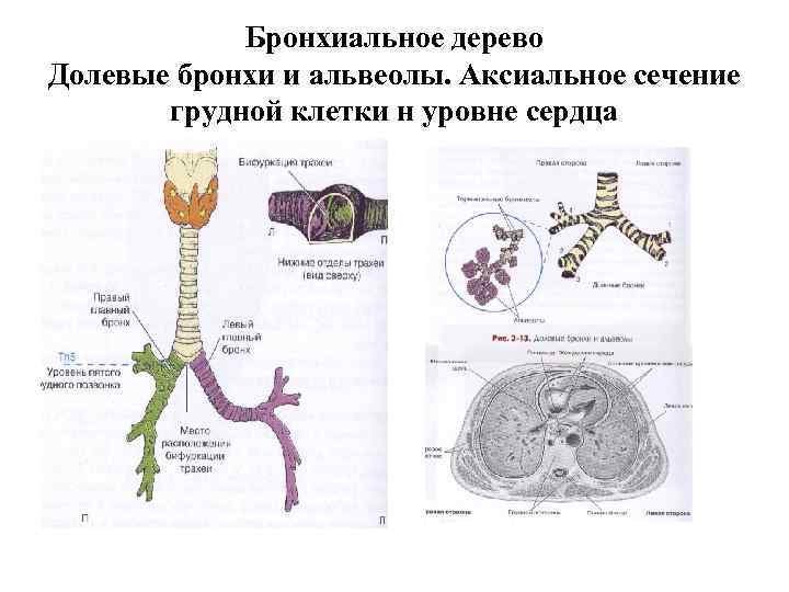   Бронхиальное дерево Долевые бронхи и альвеолы. Аксиальное сечение   грудной клетки