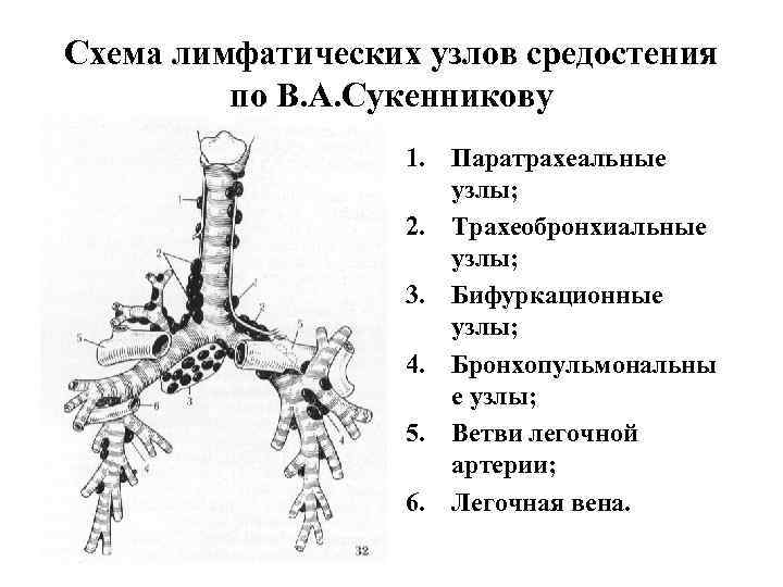 Схема лимфатических узлов средостения  по В. А. Сукенникову    1. Паратрахеальные