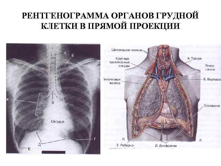РЕНТГЕНОГРАММА ОРГАНОВ ГРУДНОЙ КЛЕТКИ В ПРЯМОЙ ПРОЕКЦИИ 