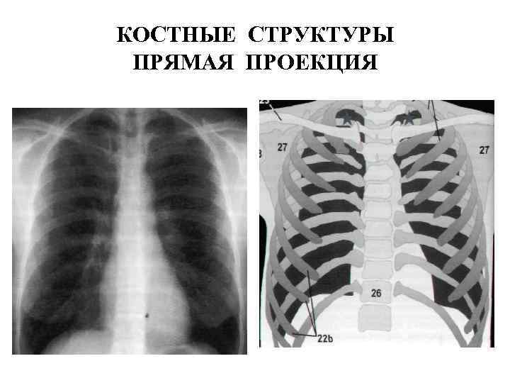 КОСТНЫЕ СТРУКТУРЫ ПРЯМАЯ ПРОЕКЦИЯ 