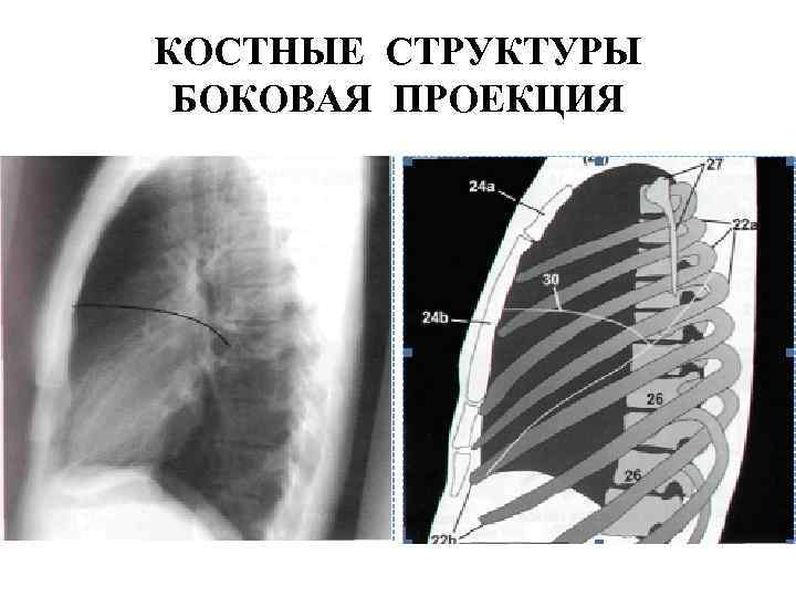 КОСТНЫЕ СТРУКТУРЫ БОКОВАЯ ПРОЕКЦИЯ 