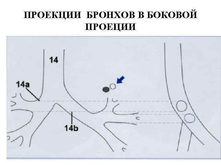 ПРОЕКЦИИ БРОНХОВ В БОКОВОЙ  ПРОЕЦИИ 