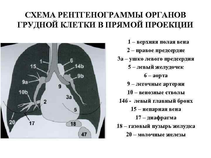 Схема описания рентгенограммы грудной клетки