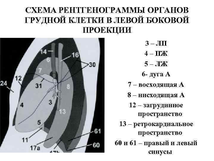СХЕМА РЕНТГЕНОГРАММЫ ОРГАНОВ ГРУДНОЙ КЛЕТКИ В ЛЕВОЙ БОКОВОЙ  ПРОЕКЦИИ    