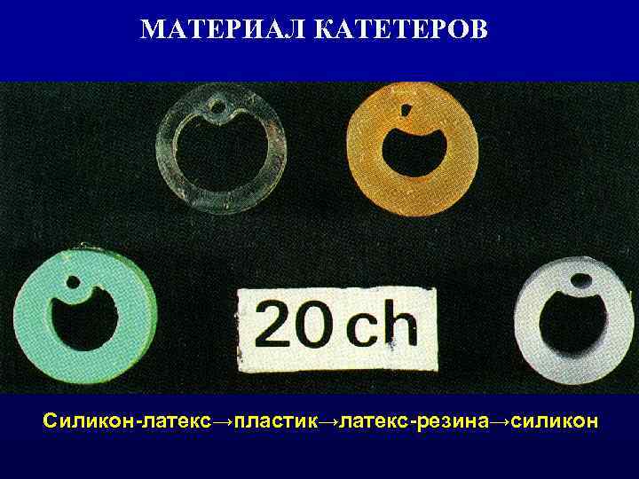   МАТЕРИАЛ КАТЕТЕРОВ Силикон-латекс→пластик→латекс-резина→силикон 