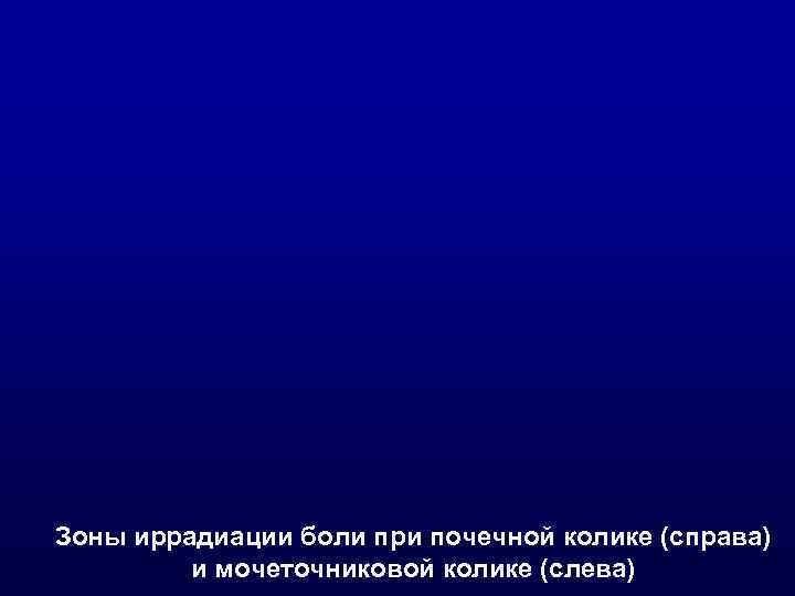 Зоны иррадиации боли при почечной колике (справа)   и мочеточниковой колике (слева) 