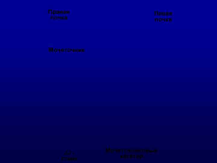 Правая    Левая почка    почка Мочеточник   JJ