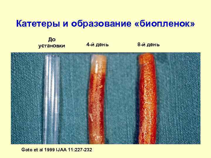 Катетеры и образование «биопленок»   До   установки  4 -й день