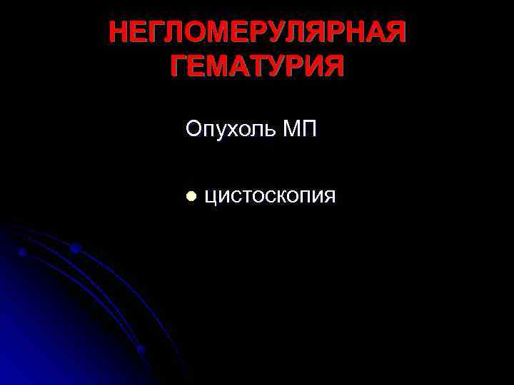 НЕГЛОМЕРУЛЯРНАЯ  ГЕМАТУРИЯ Опухоль МП l  цистоскопия 