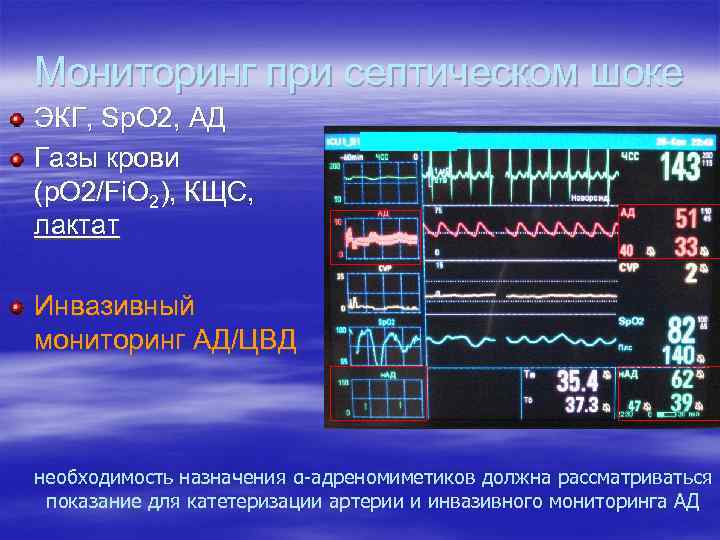 Мониторинг при септическом шоке ЭКГ, Sp. O 2, АД Газы крови (p. O 2/Fi.