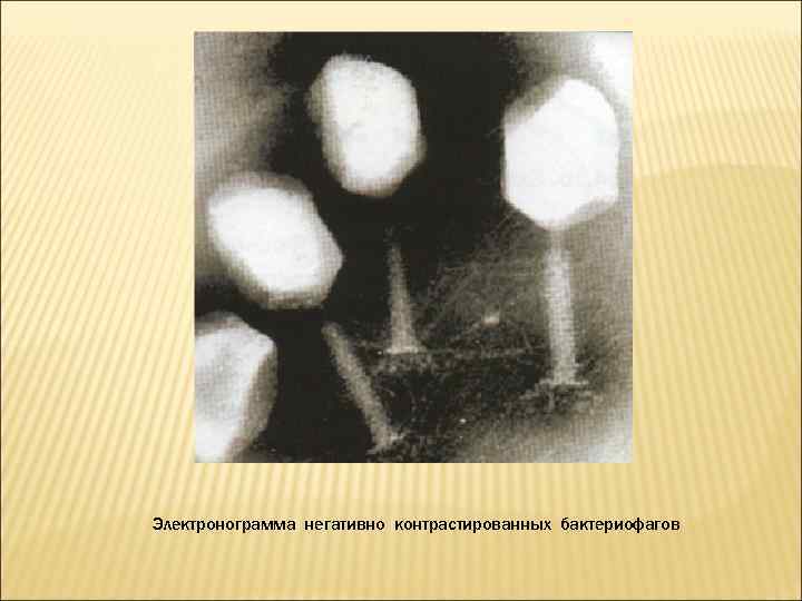 Электронограмма негативно контрастированных бактериофагов 