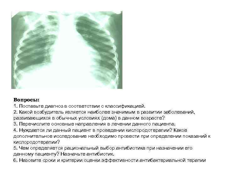 Вопросы: 1. Поставьте диагноз в соответствии с классификацией. 2. Какой возбудитель является наиболее значимым