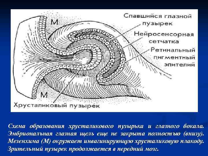 Схема образования хрусталикового пузырька и глазного бокала. Эмбрионалъная глазная щель еще не закрыта полностъю