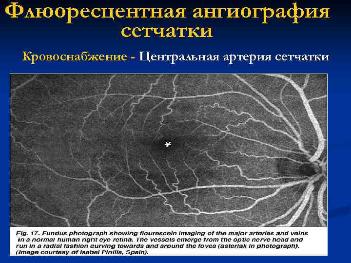 Флюоресцентная ангиография сетчатки Кровоснабжение - Центральная артерия сетчатки 