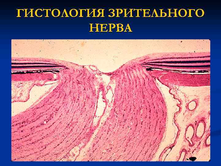 ГИСТОЛОГИЯ ЗРИТЕЛЬНОГО НЕРВА 