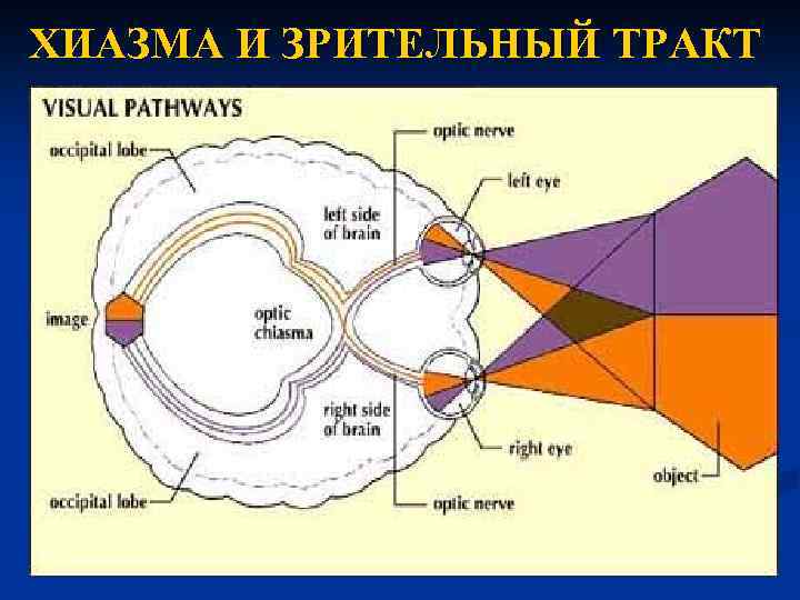 Зрительный тракт схема