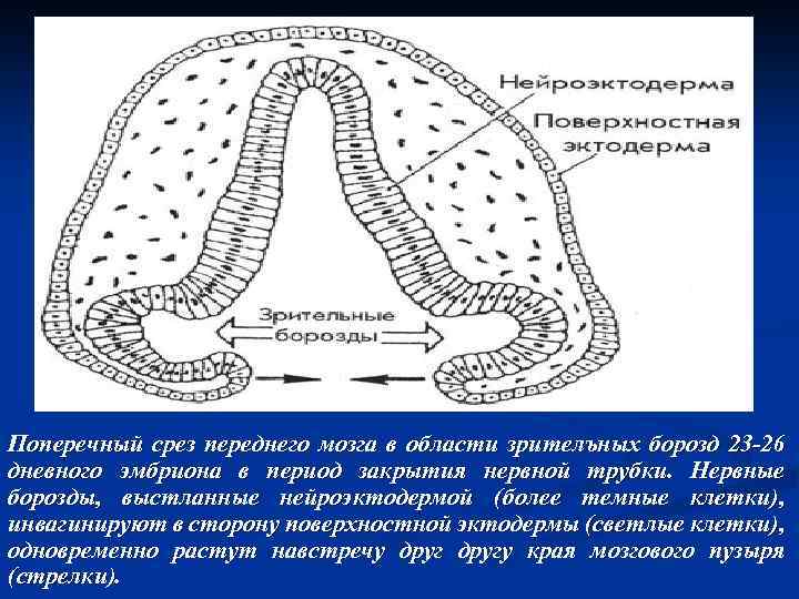 Поперечный срез переднего мозга в области зрителъных борозд 23 -26 дневного эмбриона в период