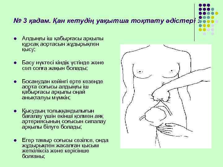 № 3 қадам. Қан кетудің уақытша тоқтату әдістері :  l  Алдыңғы іш