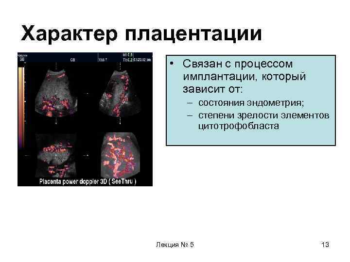 Характер плацентации    • Связан с процессом   имплантации, который 